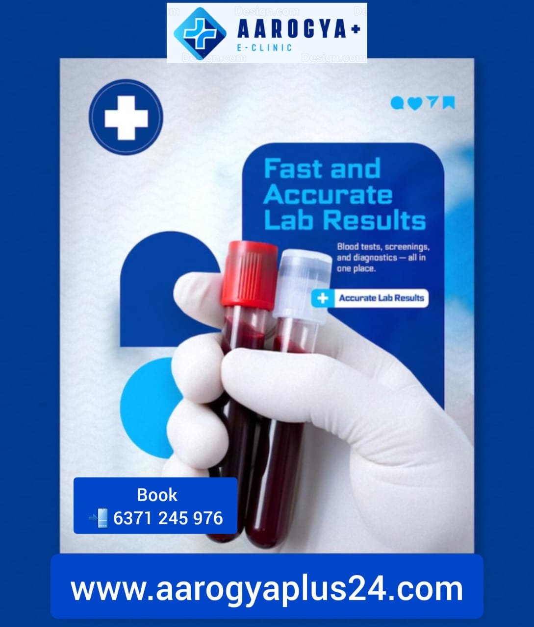 Kidney Function Test (KFT)