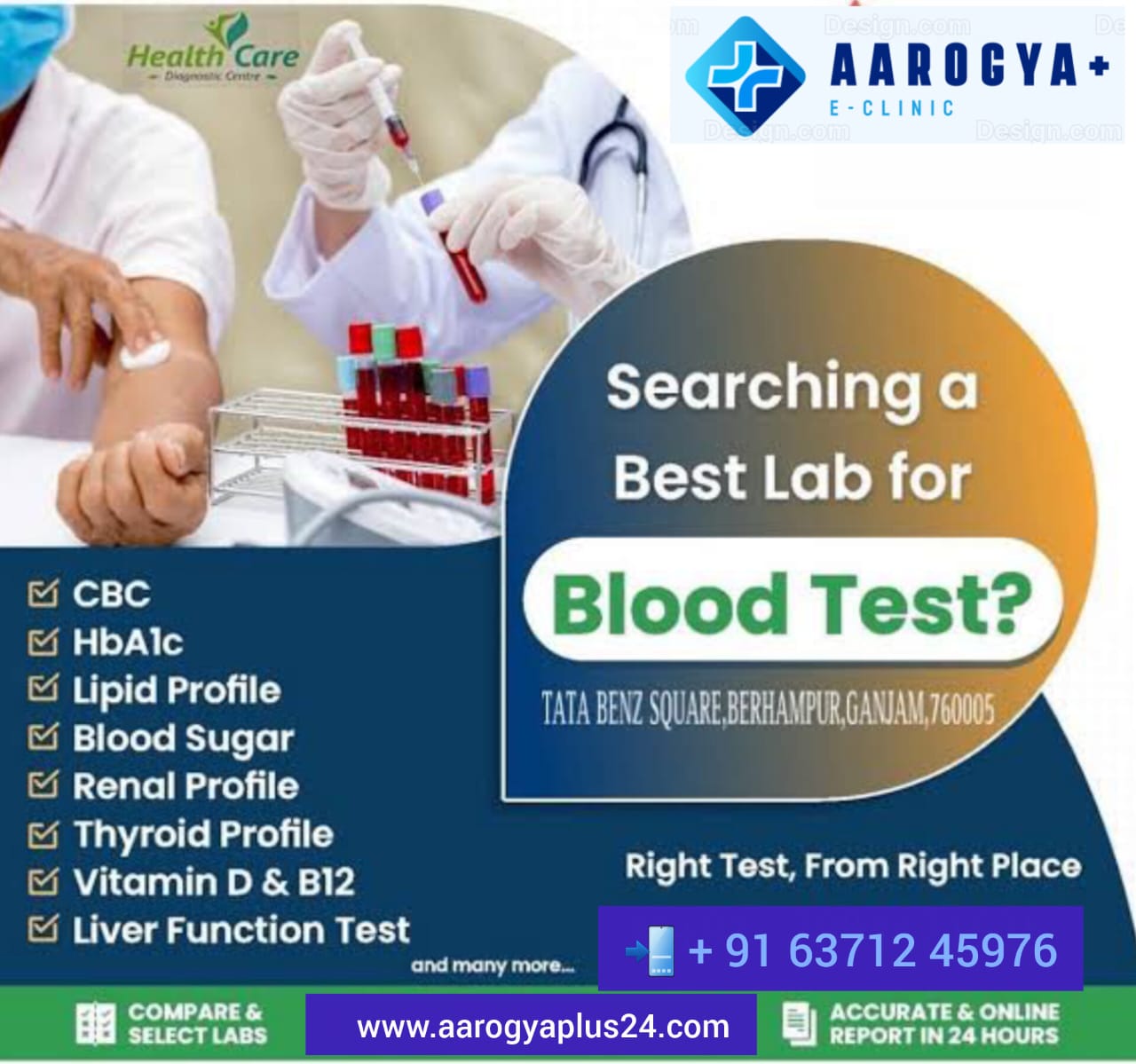 HbA1c - Glycated Hemoglobin
